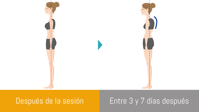 change in posture